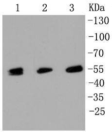 Anti-MLKL Antibody (3Z198)