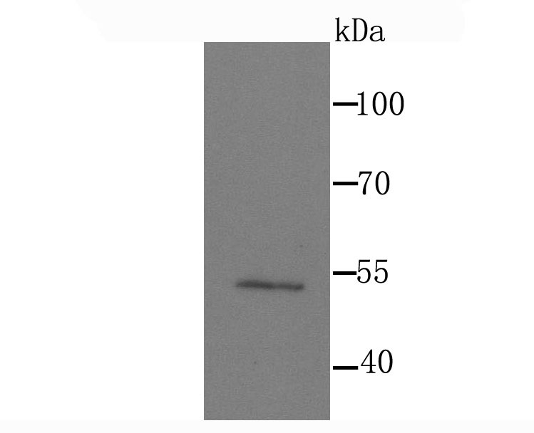 Anti-MEF2A Antibody (5F773)
