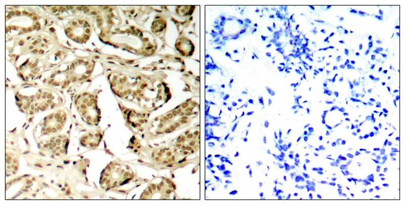 Anti-Phospho-MEF2A (Ser408) Polyclonal Antibody