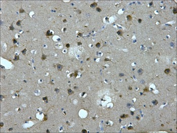 Anti-MAP2 Antibody (1Q259)