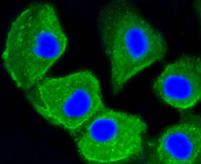 Anti-MAP1LC3A Antibody (4Q42)