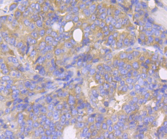 Anti-KARS Antibody (1C183)