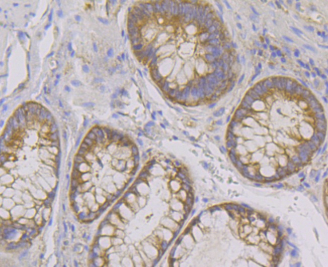 Anti-KARS Antibody (1C183)