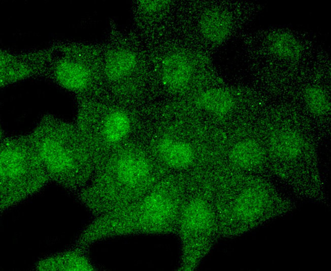Anti-MAP1LC3A Antibody (5H585)
