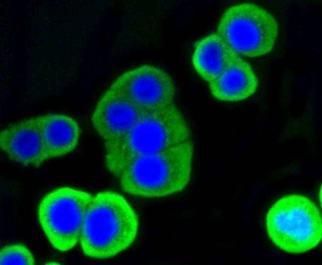 Anti-Lysozyme C Antibody (1Z83)