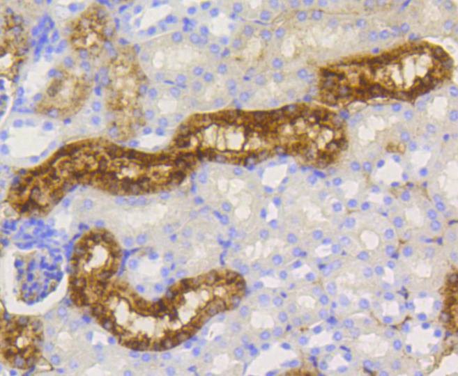 Anti-Lysozyme C Antibody (1Z83)