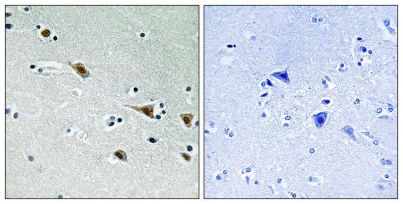 Anti-Phospho-MAP2K7 (Ser271) Polyclonal Antibody