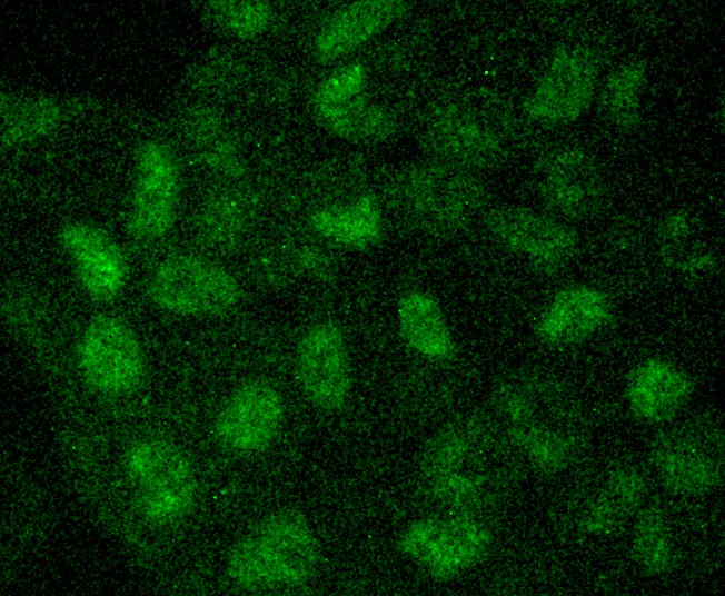 Anti-MAP1LC3A Antibody (5H585)