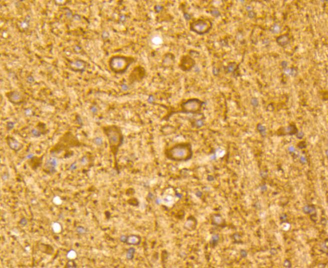 Anti-MAP1LC3A Antibody (4Q42)
