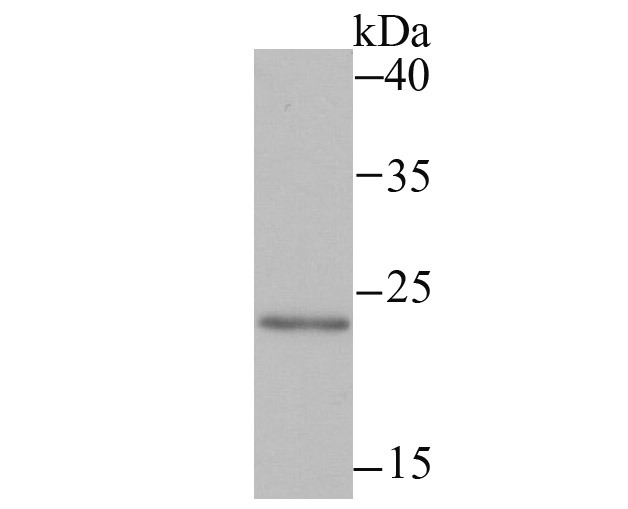 Anti-MAD2L2 Antibody (7W975)