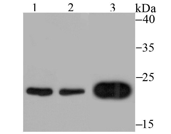 Anti-MAD2L1 Antibody (2Y202)