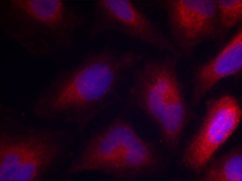 Anti-Phospho-MARCKS (Ser162) Polyclonal Antibody
