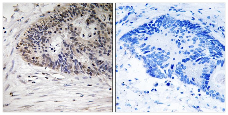 Anti-Phospho-MDMX (Ser367) Polyclonal Antibody 2