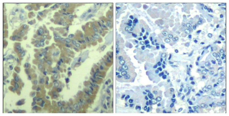 Anti-Phospho-MARCKS (Ser170) Polyclonal Antibody