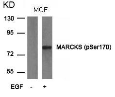 Anti-Phospho-MARCKS (Ser170) Polyclonal Antibody