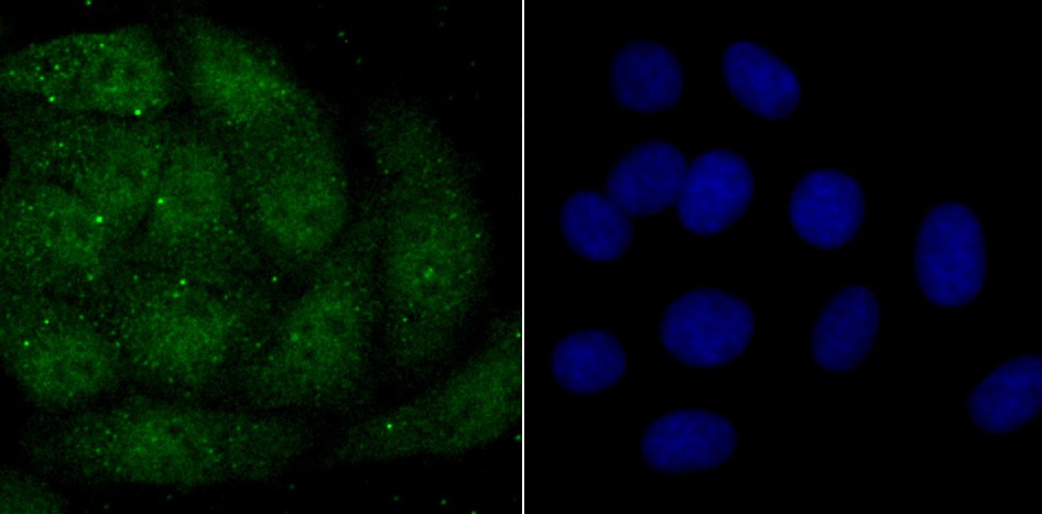 Anti-macroH2A.1 Antibody (7A412)