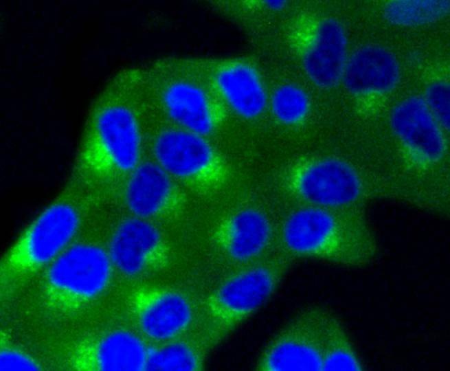 Anti-IGF2R Antibody (3T816)