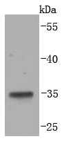 Anti-LYVE1 Antibody (3Z624)