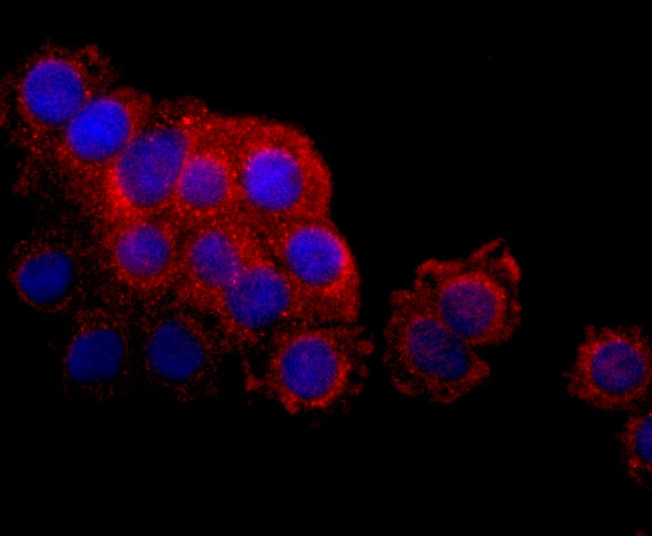 Anti-LYVE1 Antibody (3Z624)