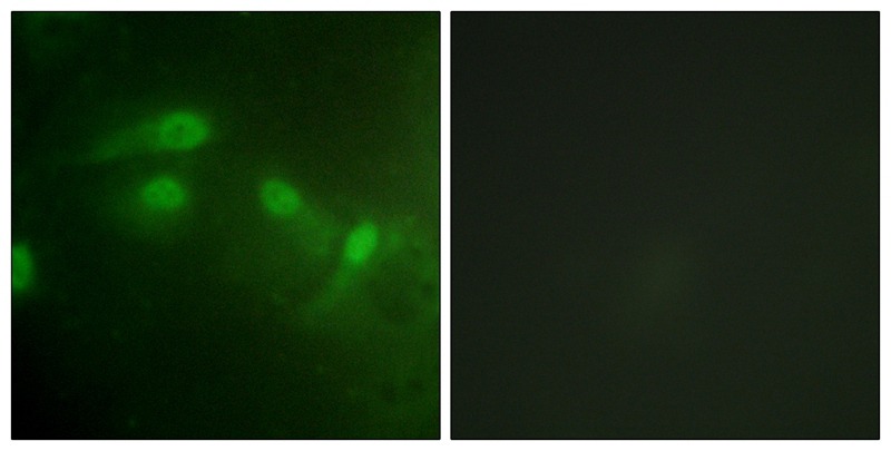 Anti-Phospho-MDM2 (Ser186, 188) Polyclonal Antibody