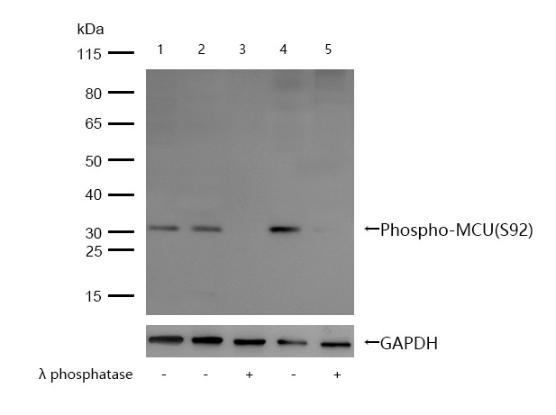 Anti-Phospho-MCU (S92) Polyclonal Antibody