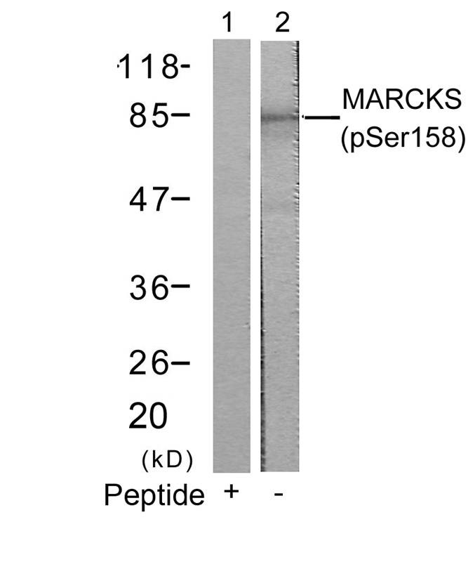 Anti-Phospho-MARCKS (Ser158) Polyclonal Antibody