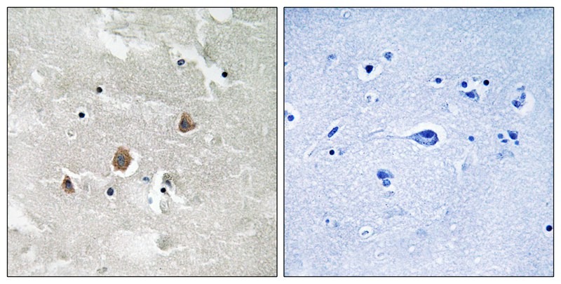 Anti-Phospho-MAP3K1 (Thr1402) Polyclonal Antibody