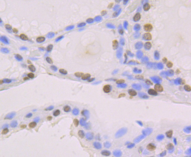 Anti-macroH2A.1 Antibody (7A412)