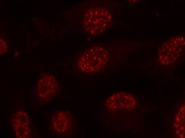 Anti-Phospho-MAPKAPK2 (Thr334) Polyclonal Antibody