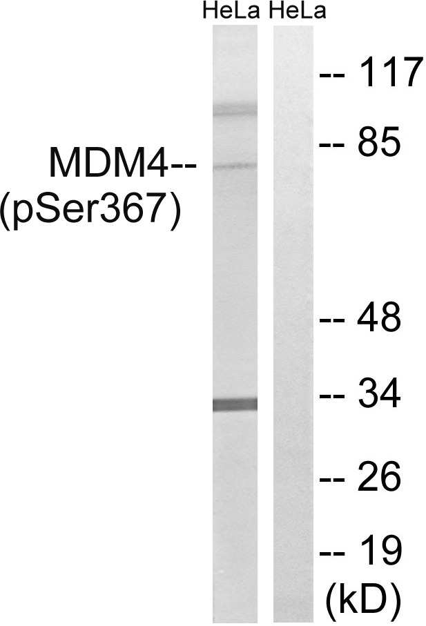 Anti-Phospho-MDMX (Ser367) Polyclonal Antibody 2
