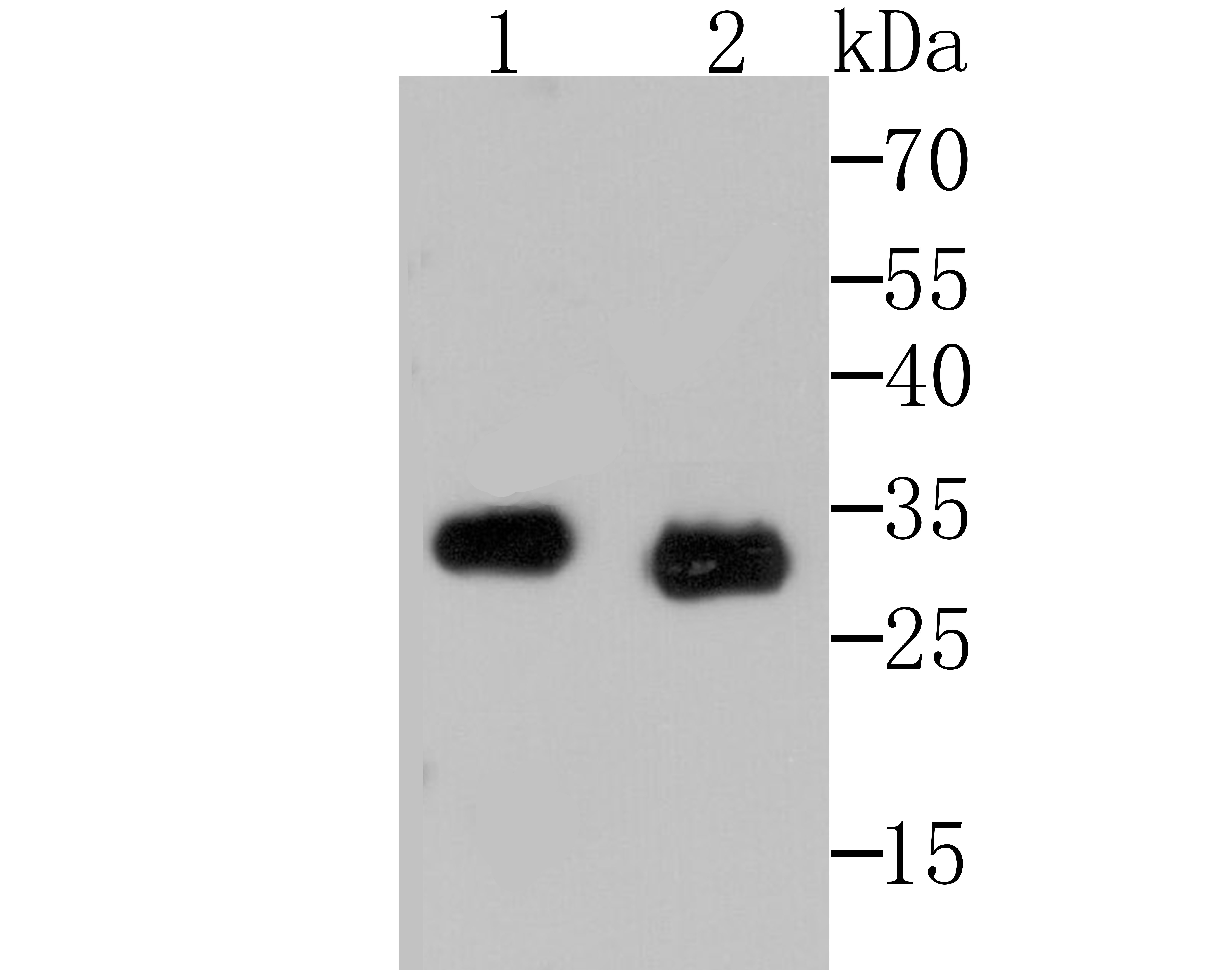 Anti-Chymase 1 Antibody (7I538)