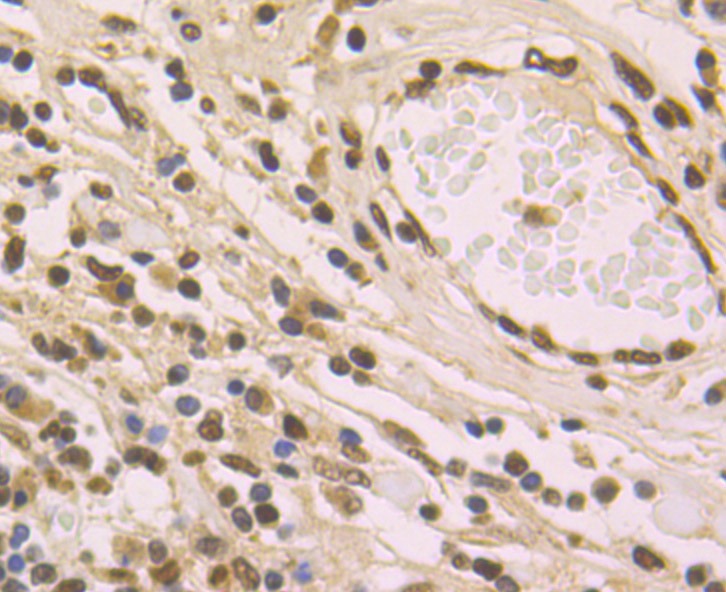 Anti-macroH2A.1 Antibody (7A412)