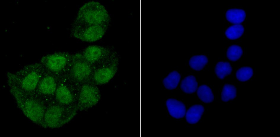 Anti-macroH2A.1 Antibody (7A412)