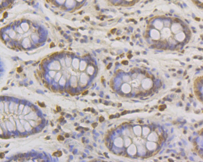 Anti-Lipin 1 Antibody (5B766)