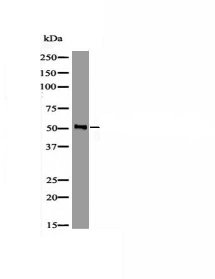 Anti-Phospho-MEF2C (Ser98) Polyclonal Antibody