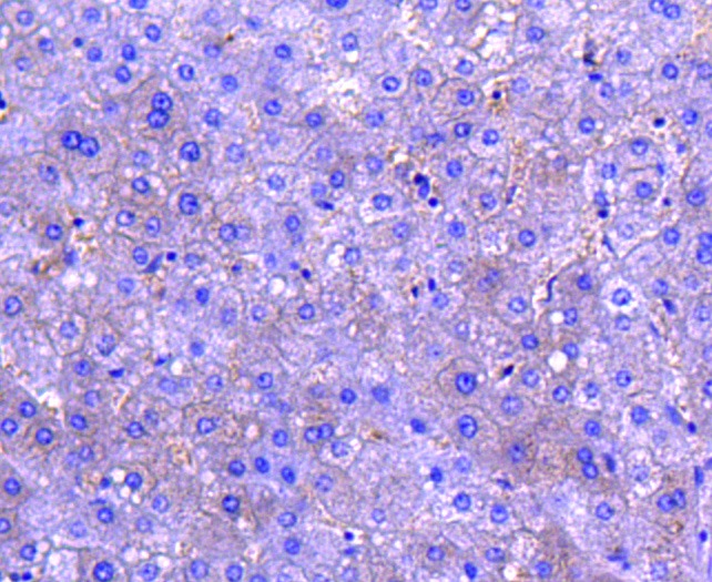 Anti-M-CSF/CSF1 Antibody (2H817)
