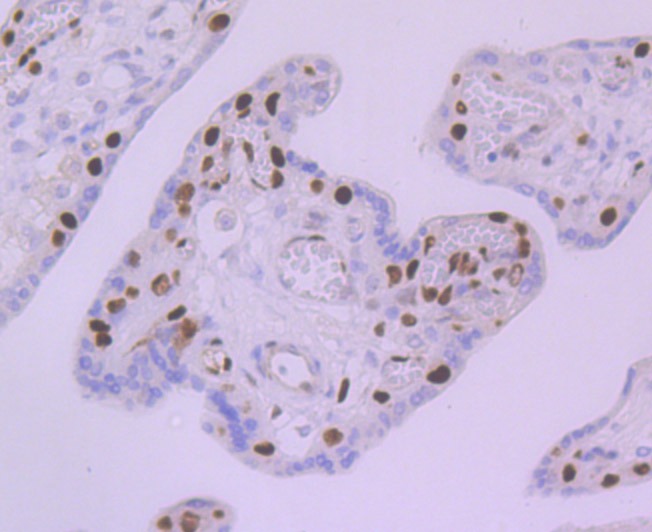 Anti-MCM5 Antibody (9C193)