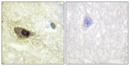 Anti-Phospho-MAP4 (Ser696) Polyclonal Antibody