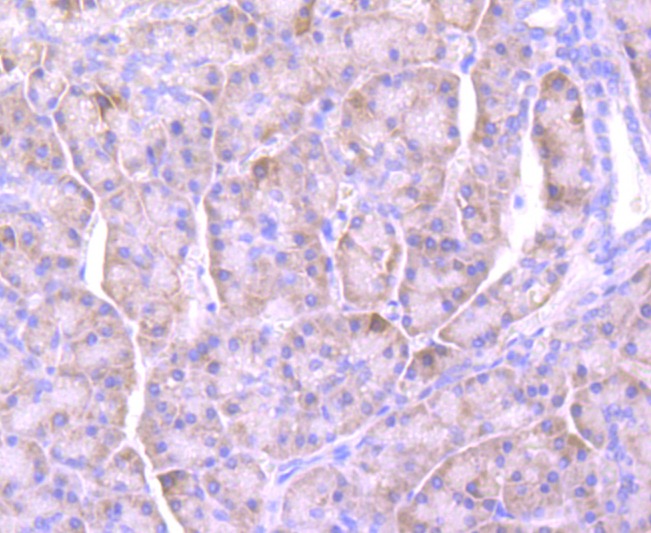 Anti-Lipocalin-2/LCN2 Antibody (7K2)