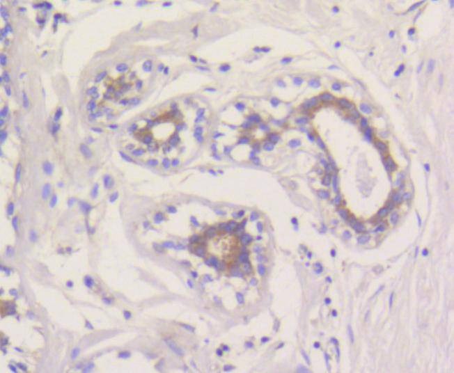 Anti-Mcl-1 Antibody (6C872)