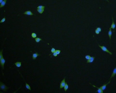 Anti-LNP Antibody (3D893)