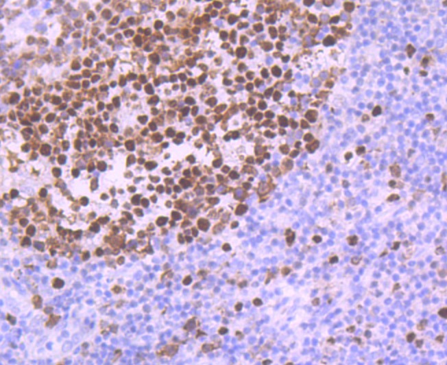 Anti-MCM5 Antibody (9C193)