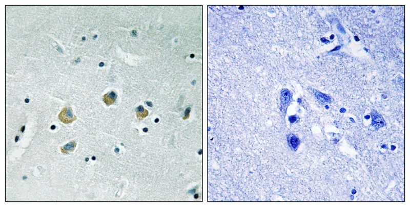 Anti-Phospho-MAP3K8 (Ser400) Polyclonal Antibody