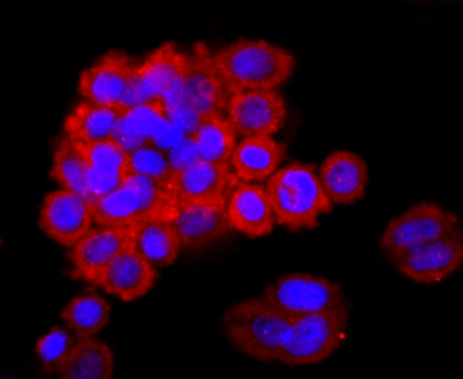 Anti-Lipocalin-2/LCN2 Antibody (7K2)