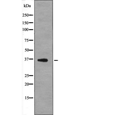 Anti-Phospho-Mcl-1 (Thr163) Polyclonal Antibody
