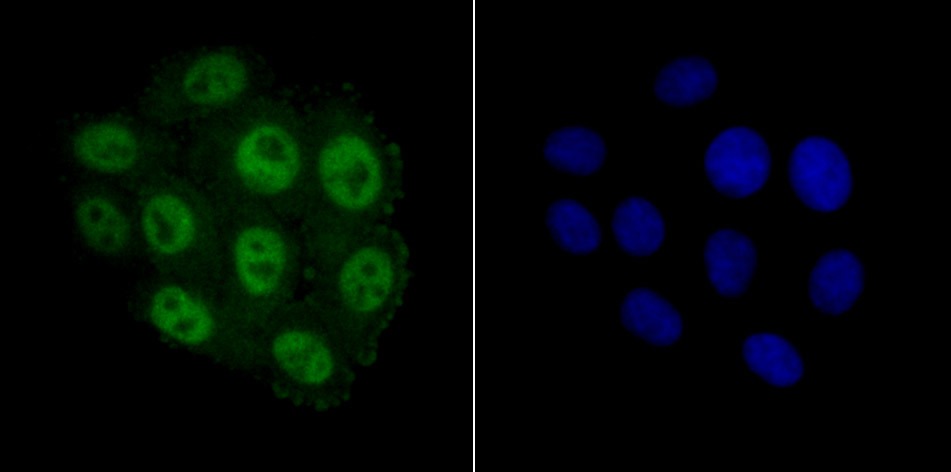 Anti-MCM3 Antibody (3T338)