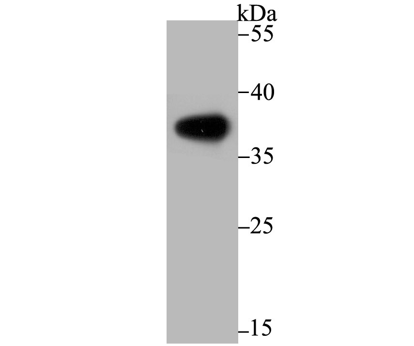 Anti-Arginase 1/ARG1 Antibody (1O924)