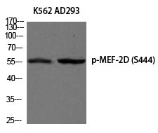 Anti-Phospho-MEF-2D (Ser444) Polyclonal Antibody