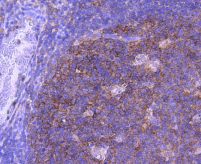 Anti-MAP2K1 Antibody (3D339)
