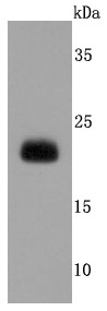 Anti-Lipocalin-2/LCN2 Antibody (7K2)